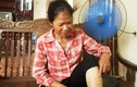 Sự thật 100 người huyện ngoại thành Hà Nội bị “chó lạ” cắn